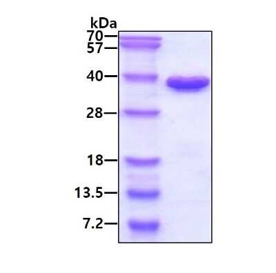 SDS-PAGE: Recombinant Human CHMP6 His Protein [NBP1-99015]